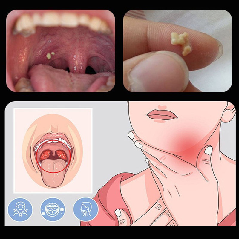 ~Ear Wax Tonsil Stone Remover  - Ear Wax Remover incelemesi ve fiyatı
