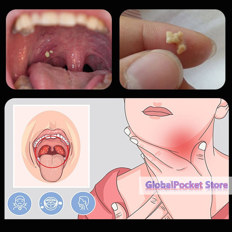 [TG823]Ear Wax Tonsil Stone Re - Ear Wax Remover incelemesi ve fiyatı